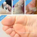 exfoliating foot peel off mask Moisturize foot skin